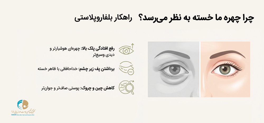 دلایل خستگی چشم ها و راه حل آن