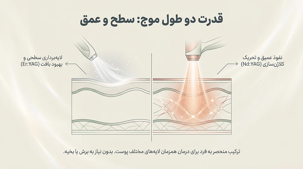 روش کار لیزر فوتونا در نورسیما
